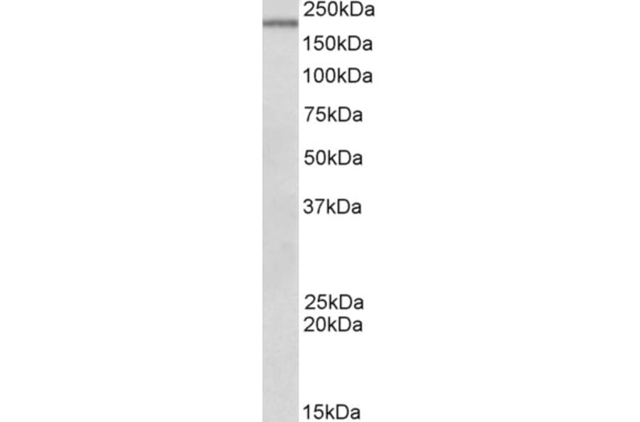 Western Blot - Anti-Dennd4c Antibody (A82741) - Antibodies.com