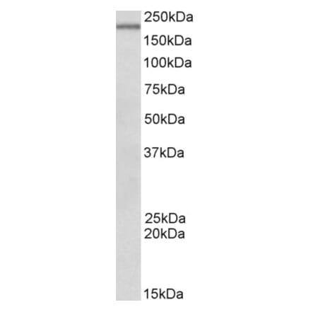 Western Blot - Anti-Dennd4c Antibody (A82741) - Antibodies.com