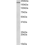 Western Blot - Anti-Dennd4c Antibody (A82741) - Antibodies.com