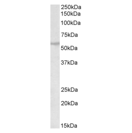 Western Blot - Anti-RNF36 Antibody (A82742) - Antibodies.com