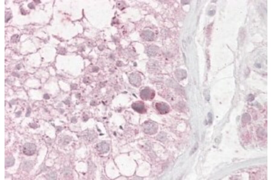 Immunohistochemistry - Anti-RNF36 Antibody (A82742) - Antibodies.com