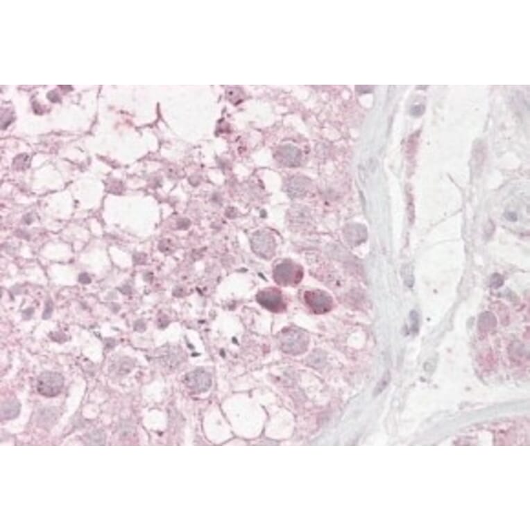 Immunohistochemistry - Anti-RNF36 Antibody (A82742) - Antibodies.com