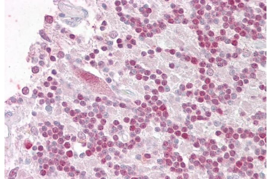 Immunohistochemistry - Anti-RNF36 Antibody (A82742) - Antibodies.com