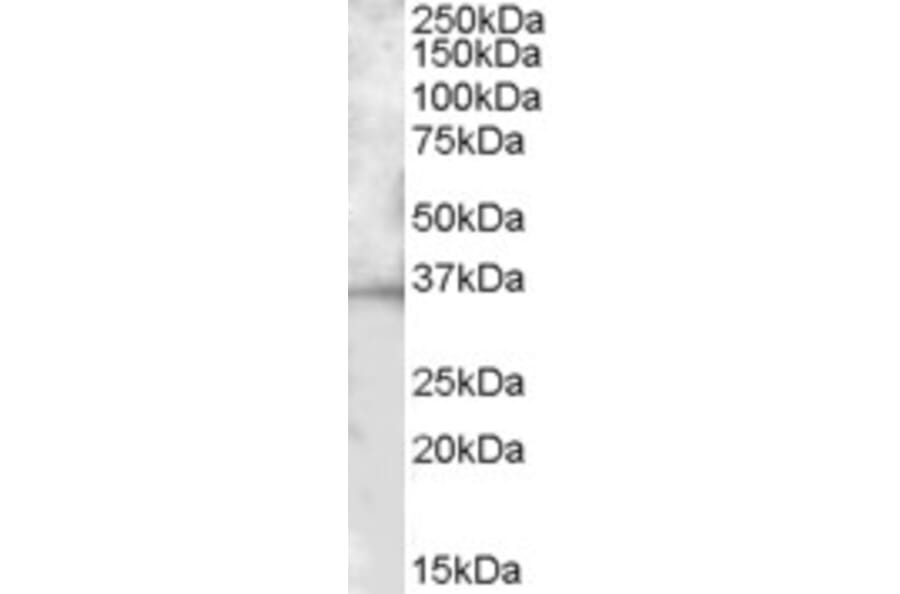 Western Blot - Anti-CD272/BTLA Antibody (A82744) - Antibodies.com