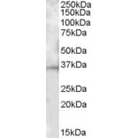 Western Blot - Anti-CD272/BTLA Antibody (A82744) - Antibodies.com