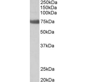 Western Blot - Anti-TGM6 Antibody (A82747) - Antibodies.com