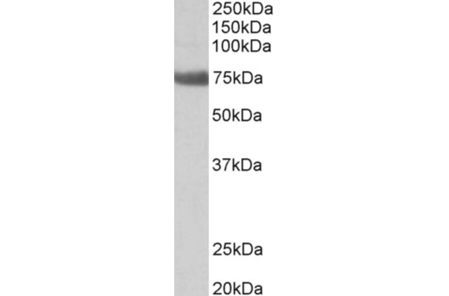 Western Blot - Anti-TGM6 Antibody (A82747) - Antibodies.com