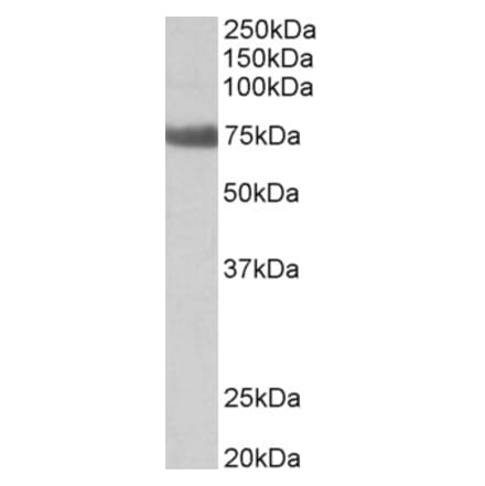 Western Blot - Anti-TGM6 Antibody (A82747) - Antibodies.com