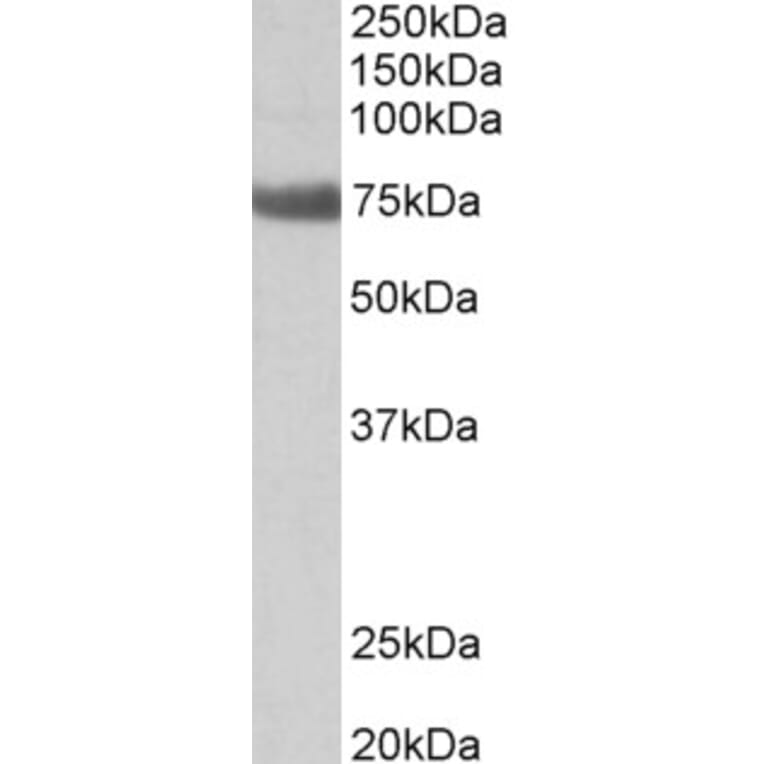 Western Blot - Anti-TGM6 Antibody (A82747) - Antibodies.com