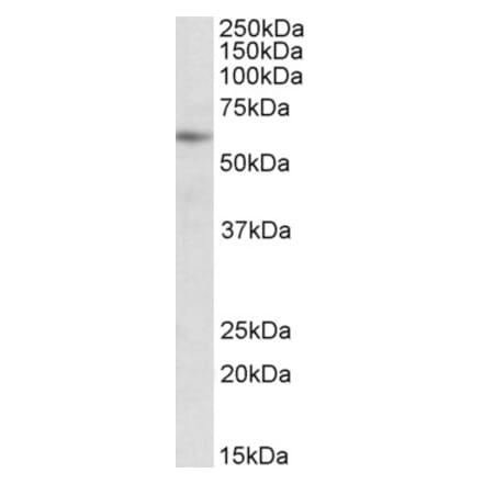 Western Blot - Anti-PIAS2 Antibody (A82748) - Antibodies.com