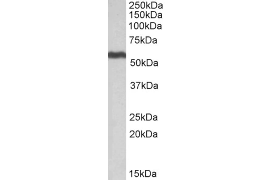 Western Blot - Anti-ALDH5A1/SSADH Antibody (A82749) - Antibodies.com