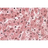 Immunohistochemistry - Anti-ALDH5A1/SSADH Antibody (A82749) - Antibodies.com