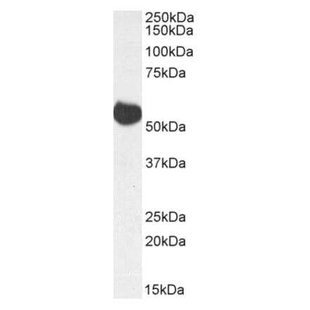 ALDH5A1 Antibodies + 