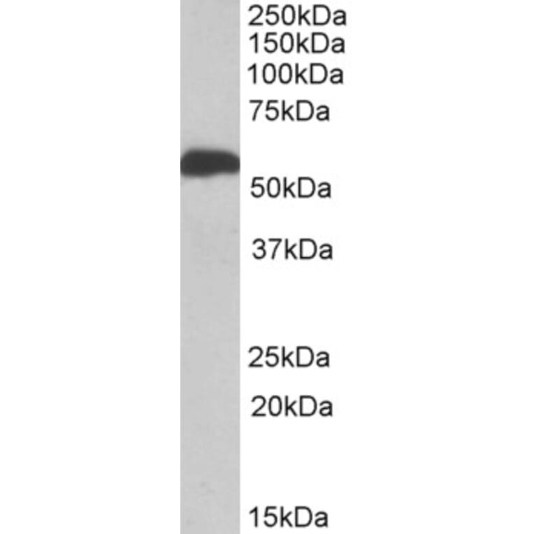 Western Blot - Anti-ALDH5A1/SSADH Antibody (A82751) - Antibodies.com