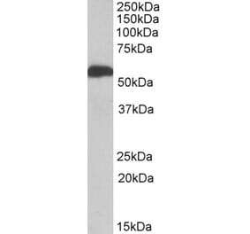 Western Blot - Anti-ALDH5A1 Antibody (A82751)