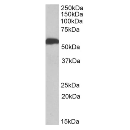 ALDH5A1 Antibodies + 