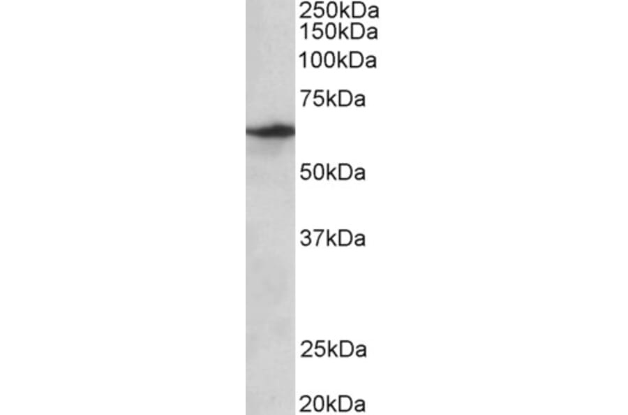Western Blot - Anti-SLC47A2 Antibody (A82752) - Antibodies.com