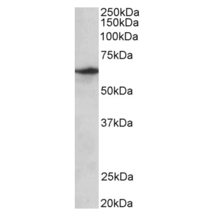 Western Blot - Anti-SLC47A2 Antibody (A82752) - Antibodies.com