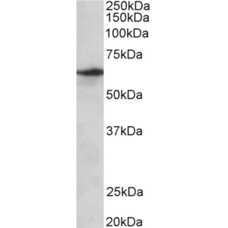 Western Blot - Anti-SLC47A2 Antibody (A82752) - Antibodies.com