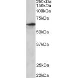 Western Blot - Anti-SLC47A2 Antibody (A82752) - Antibodies.com