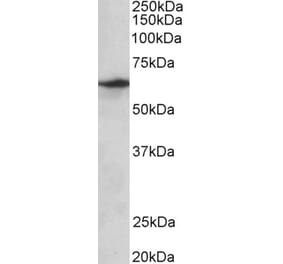 Western Blot - Anti-SLC47A2 Antibody (A82752) - Antibodies.com
