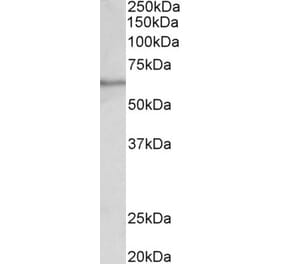 Western Blot - Anti-SLC47A2 Antibody (A82753) - Antibodies.com