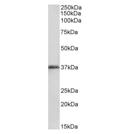 Western Blot - Anti-MSI2 Antibody (A82754) - Antibodies.com