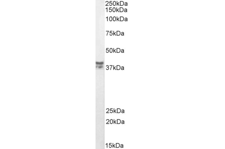 Western Blot - Anti-MSI2 Antibody (A82754) - Antibodies.com