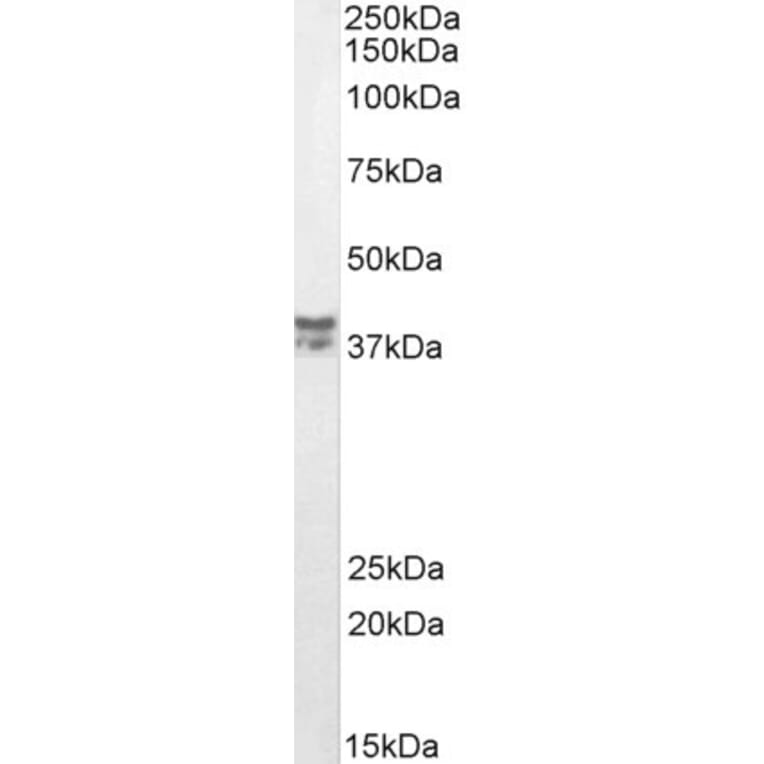 Western Blot - Anti-MSI2 Antibody (A82754) - Antibodies.com