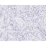 Immunohistochemistry - Anti-NIPBL Antibody (A82755) - Antibodies.com