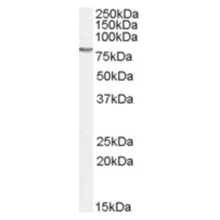 Western Blot - Anti-GAB2 Antibody (A82758) - Antibodies.com