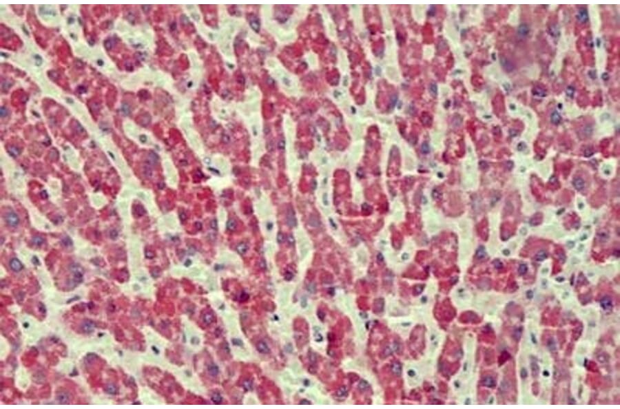 Immunohistochemistry - Anti-ANTXR2/CMG-2 Antibody (A82760) - Antibodies.com