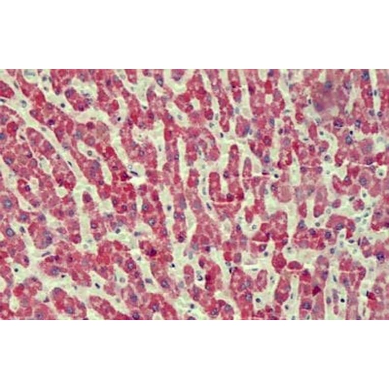 Immunohistochemistry - Anti-ANTXR2/CMG-2 Antibody (A82760) - Antibodies.com