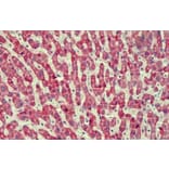 Immunohistochemistry - Anti-ANTXR2/CMG-2 Antibody (A82760) - Antibodies.com