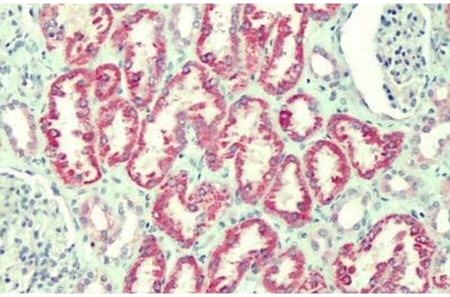 Immunohistochemistry - Anti-ANTXR2/CMG-2 Antibody (A82760) - Antibodies.com