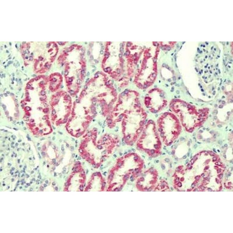 Immunohistochemistry - Anti-ANTXR2/CMG-2 Antibody (A82760) - Antibodies.com