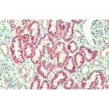 Immunohistochemistry - Anti-ANTXR2/CMG-2 Antibody (A82760) - Antibodies.com