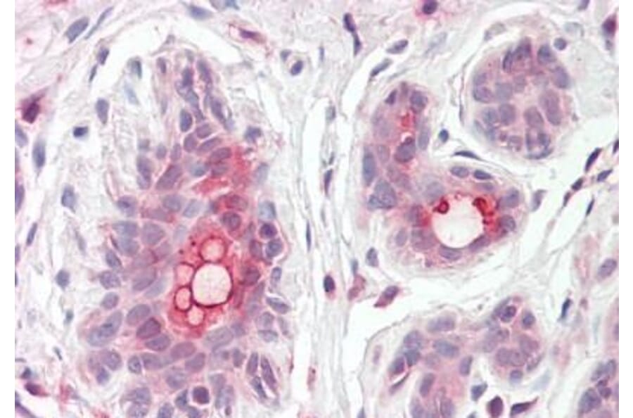 Immunohistochemistry - Anti-MRP8 Antibody (A82762) - Antibodies.com