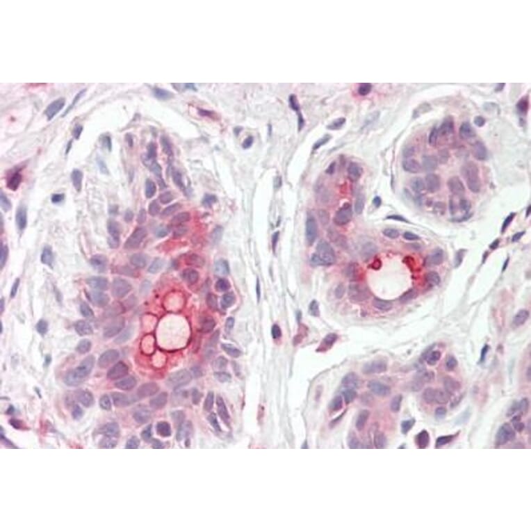 Immunohistochemistry - Anti-MRP8 Antibody (A82762) - Antibodies.com