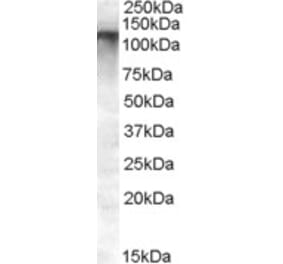 Western Blot - Anti-ABCC11 Antibody (A82762) - Antibodies.com