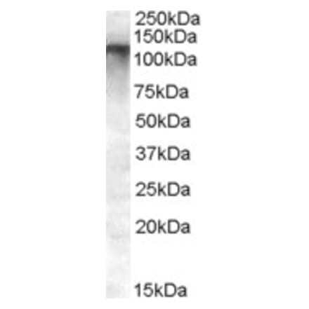 Western Blot - Anti-ABCC11 Antibody (A82762) - Antibodies.com