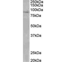 Western Blot - Anti-CLLD8/SETDB2 Antibody (A82764) - Antibodies.com