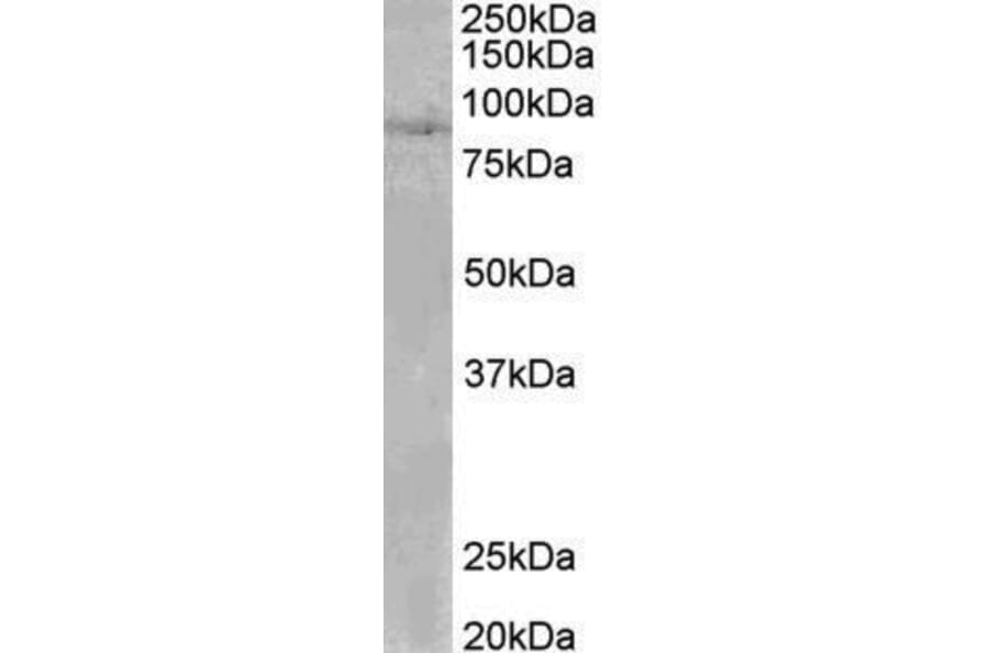 Western Blot - Anti-CLLD8/SETDB2 Antibody (A82764) - Antibodies.com