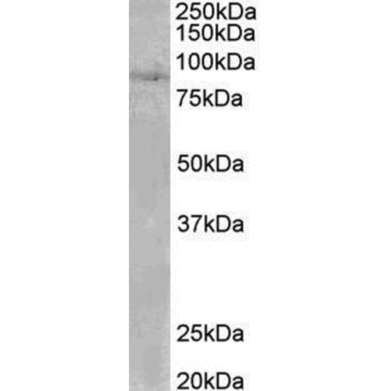 Western Blot - Anti-CLLD8/SETDB2 Antibody (A82764) - Antibodies.com