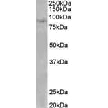Western Blot - Anti-CLLD8/SETDB2 Antibody (A82764) - Antibodies.com