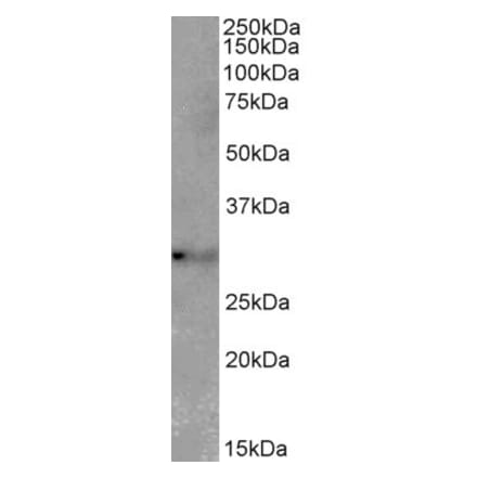 Western Blot - Anti-TSPAN14 Antibody (A82765) - Antibodies.com