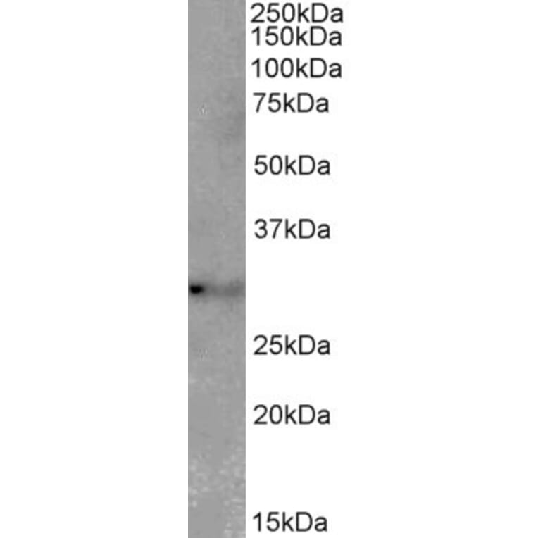 Western Blot - Anti-TSPAN14 Antibody (A82765) - Antibodies.com