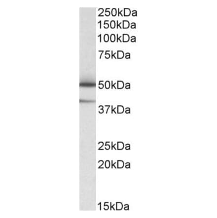 Western Blot - Anti-TXNDC5 Antibody (A82766) - Antibodies.com