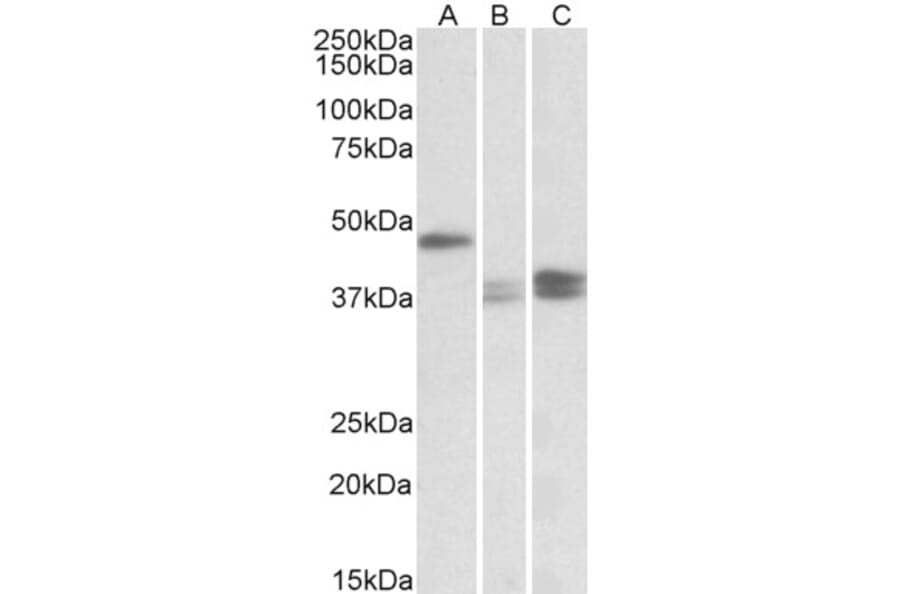 Western Blot - Anti-TXNDC5 Antibody (A82766) - Antibodies.com
