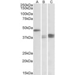 Western Blot - Anti-TXNDC5 Antibody (A82766) - Antibodies.com